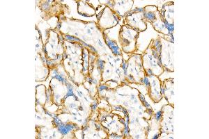Immunohistochemistry of paraffin-embedded Human placenta using CD147/BSG antibody (ABIN7265838) at dilution of 1:100 (40x lens). (CD147 抗体)