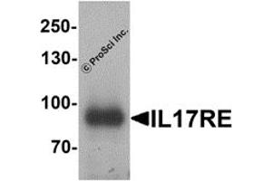 Western Blotting (WB) image for anti-Interleukin 17 Receptor E (IL17RE) antibody (ABIN1077424) (IL17RE 抗体)