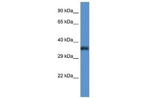 Western Blot showing PIGC antibody used at a concentration of 1 ug/ml against Fetal Lung Lysate (PIGC 抗体  (C-Term))
