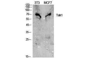 Western Blotting (WB) image for anti-Nuclear Receptor Subfamily 2, Group C, Member 2 (NR2C2) (Tyr142) antibody (ABIN3187165) (TR4 抗体  (Tyr142))