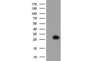 HEK293T cells were transfected with the pCMV6-ENTRY control (Left lane) or pCMV6-ENTRY GSTT2 (Right lane) cDNA for 48 hrs and lysed. (GSTT2 抗体)