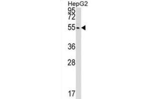 Western Blotting (WB) image for anti-Cleavage and Polyadenylation Factor I Subunit 1 (CLP1) antibody (ABIN2999240) (CLP1 抗体)