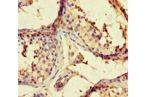 Immunohistochemistry of paraffin-embedded human testis tissue using ABIN7167960 at dilution of 1:100 (ARHGAP42 抗体  (AA 541-728))