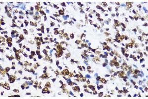 Immunohistochemistry of paraffin-embedded Human appendix using Acetyl-Histone H4-K12 Polyclonal Antibody at dilution of 1:200 (40x lens). (Histone H4 抗体  (acLys12))