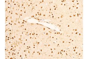 ABIN6267286 at 1/100 staining rat brain tissue sections by IHC-P.