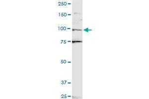 ZNF598 polyclonal antibody (A01). (ZNF598 抗体  (AA 28-126))