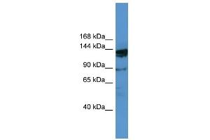 WB Suggested Anti-OGDHL Antibody Titration: 0. (OGDHL 抗体  (N-Term))