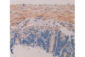 Used in DAB staining on fromalin fixed paraffin- embedded intestine tissue (MAP1A 抗体  (AA 2110-2367))