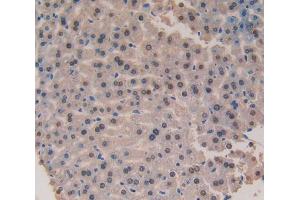 Used in DAB staining on fromalin fixed paraffin- embedded liver tissue (Galectin 6 抗体  (AA 1-301))