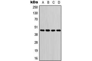 Western blot analysis of GOT1 expression in Jurkat (A), A549 (B), PC12 (C), H9C2 (D) whole cell lysates. (GOT1 抗体  (N-Term))