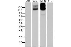 Image no. 5 for anti-ATP-Binding Cassette, Sub-Family B (MDR/TAP), Member 1 (ABCB1) (AA 995-1280) antibody (ABIN1491725)