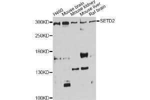 Western blot analysis of extracts of various cell lines, using SETD2 antibody. (SETD2 抗体)