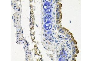 Immunohistochemistry of paraffin-embedded Mouse lung using MARK1 Polyclonal Antibody at dilution of 1:100 (40x lens). (MARK1 抗体)