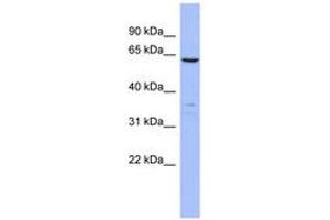 Image no. 1 for anti-Plastin 1 (PLS1) (AA 71-120) antibody (ABIN6744070) (PLS1 抗体  (AA 71-120))