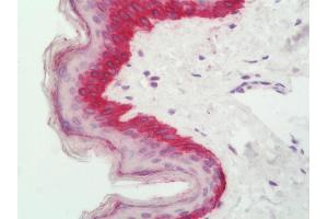 Immunohistochemistry (IHC) image for anti-Cysteine Dioxygenase, Type I (CDO1) (N-Term) antibody (ABIN2597732)