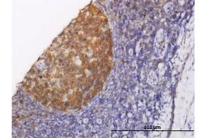 Immunoperoxidase of monoclonal antibody to NOLC1 on formalin-fixed paraffin-embedded human tonsil. (NOLC1 抗体  (AA 590-699))