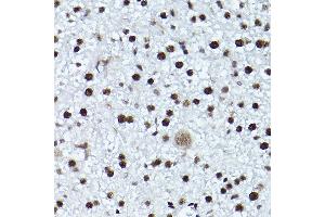 Immunohistochemistry of paraffin-embedded mouse liver using Phospho-ATR-T1989 Rabbit pAb (ABIN7265777) at dilution of 1:200 (40x lens).
