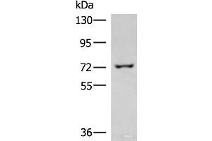 Western blot analysis of 293T cell lysate using GLS Polyclonal Antibody at dilution of 1:850 (Glutaminase 抗体)