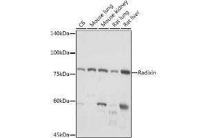 Western blot analysis of extracts of various cell lines, using Radixin Rabbit mAb (ABIN7269833) at 1:1000 dilution. (Radixin 抗体)