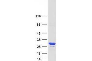 Validation with Western Blot