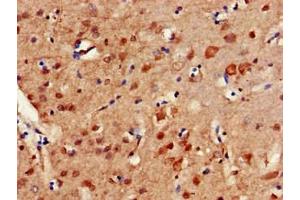 Immunohistochemistry of paraffin-embedded human brain tissue using ABIN7150279 at dilution of 1:100 (ERCC4 抗体  (AA 656-753))