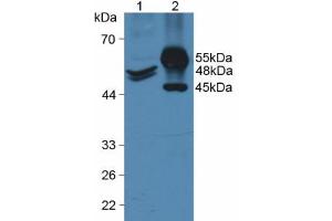 Western blot analysis of (1) Human HeLa cells and (2) Porcine Intestine Tissue. (KRT20 抗体  (AA 9-424))