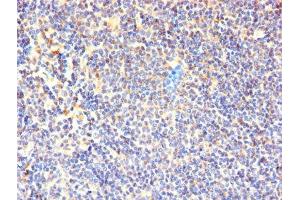 Immunohistochemistry of paraffin-embedded human lymphoid tissue using ABIN7171334 at dilution of 1:100 (CD7 抗体  (AA 26-180))