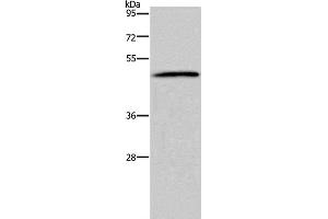 Western Blot analysis of 293T cell using HTR2B Polyclonal Antibody at dilution of 1:500 (Serotonin Receptor 2B 抗体)