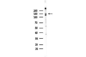 anti-Ring Finger Protein 123 (RNF123) (N-Term) antibody