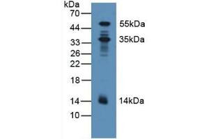Detection of PDXK in Human Lung Tissue using Polyclonal Antibody to Pyridoxal Kinase (PDXK) (PDXK 抗体  (AA 29-253))
