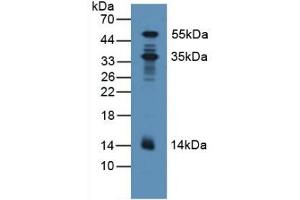 Detection of PDXK in Human Lung Tissue using Polyclonal Antibody to Pyridoxal Kinase (PDXK) (PDXK 抗体  (AA 29-253))