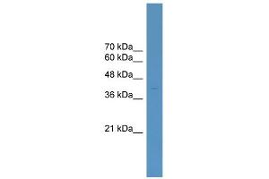 WB Suggested Anti-ELK4 Antibody Titration:  0. (ELK4 抗体  (C-Term))