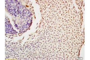 Formalin-fixed and paraffin embedded mouse tooth germ tissue labeled with Anti-Nanog Polyclonal Antibody , Unconjugated at 1:200, followed by conjugation to the secondary antibody and DAB staining (Nanog 抗体  (AA 71-170))