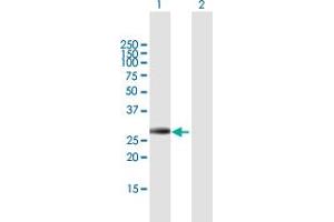 Western Blot analysis of IGFBP4 expression in transfected 293T cell line by IGFBP4 MaxPab polyclonal antibody. (IGFBP4 抗体  (AA 1-258))