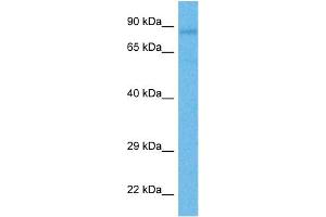 Host:  Rabbit  Target Name:  RIPK4  Sample Tissue:  Human HT1080 Whole Cell  Antibody Dilution:  1ug/ml (RIPK4 抗体  (Middle Region))