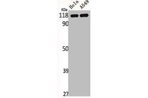Western Blot analysis of HELA A549 cells using IARS2 Polyclonal Antibody (IARS2 抗体  (N-Term))