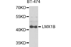 Western blot analysis of extracts of BT-474 cells, using LMX1B antibody. (LMX1B 抗体)