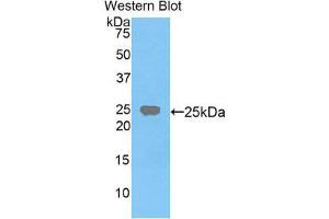 Western Blotting (WB) image for anti-Farnesyl-Diphosphate Farnesyltransferase 1 (FDFT1) (AA 217-416) antibody (ABIN3206187) (FDFT1 抗体  (AA 217-416))