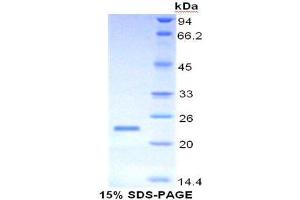 SDS-PAGE analysis of Human Mucin 4 Protein. (MUC4 蛋白)