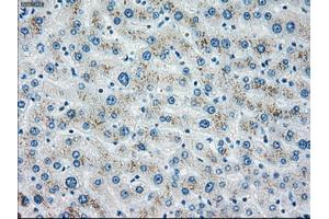 Immunohistochemical staining of paraffin-embedded liver tissue using anti-CHEK2mouse monoclonal antibody. (CHEK2 抗体)
