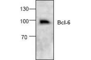 Image no. 1 for anti-B-Cell CLL/lymphoma 6 (BCL6) (C-Term) antibody (ABIN127089) (BCL6 抗体  (C-Term))