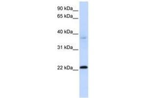 Image no. 1 for anti-Chromosome 11 Open Reading Frame 74 (C11ORF74) (C-Term) antibody (ABIN6741150) (C11ORF74 抗体  (C-Term))