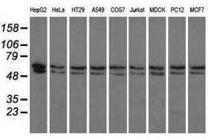 Image no. 3 for anti-Pantothenate Kinase 2 (PANK2) antibody (ABIN1500026) (PANK2 抗体)