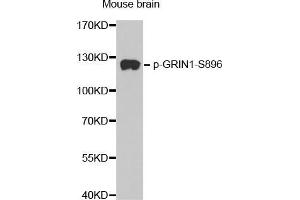Western Blotting (WB) image for anti-Glutamate Receptor, Ionotropic, N-Methyl D-Aspartate 1 (GRIN1) (pSer896) antibody (ABIN1681627) (GRIN1/NMDAR1 抗体  (pSer896))