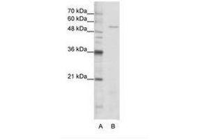 Image no. 1 for anti-Serine--tRNA Ligase, Cytoplasmic-Like (AA 241-290) antibody (ABIN202696) (Serine--tRNA Ligase, Cytoplasmic-Like (AA 241-290) 抗体)