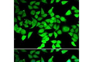 Immunofluorescence analysis of MCF-7 cells using HDAC7 Polyclonal Antibody (HDAC7 抗体)