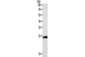 Gel: 12 % SDS-PAGE, Lysate: 40 μg, Lane: Hela cells, Primary antibody: ABIN7131115(SNAP25 Antibody) at dilution 1/400, Secondary antibody: Goat anti rabbit IgG at 1/8000 dilution, Exposure time: 10 seconds (SNAP25 抗体)