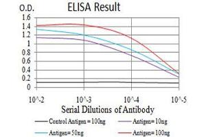 Black line: Control Antigen (100 ng), Purple line: Antigen(10 ng), Blue line: Antigen (50 ng), Red line: Antigen (100 ng), (ATF3 抗体  (AA 1-181))