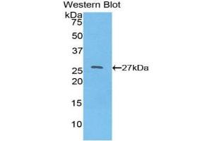 Detection of Recombinant HNF4a, Human using Polyclonal Antibody to Hepatocyte Nuclear Factor 4 Alpha (HNF4a) (HNF4A 抗体  (AA 131-330))