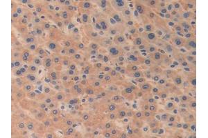 Figure. (ODC1 抗体  (AA 15-259))